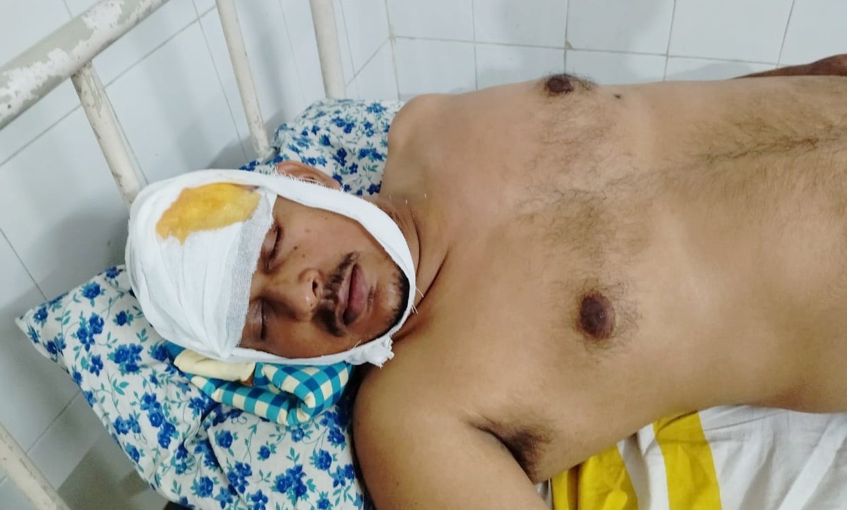 You are currently viewing ଜେଏସ୍ପିଏଲ୍ କର୍ମଚାରୀଙ୍କୁ ମରଣାନ୍ତକ ଆକ୍ରମଣ