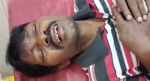 Read more about the article ରାଗରେ ସ୍ଵାମୀର ଯୌନାଙ୍ଗ କାଟିଦେଲା ସ୍ତ୍ରୀ, ଗୁରୁତର ଅବସ୍ଥାରେ ହସ୍ପିଟାଲରେ ଭର୍ତ୍ତି