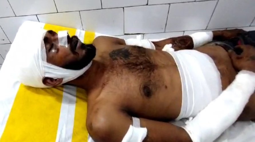 You are currently viewing ଦୁଇ ଯୁବକଙ୍କୁ ମରଣାନ୍ତକ ଆକ୍ରମଣ, ହସ୍ପିଟାଲରେ ଭର୍ତ୍ତି