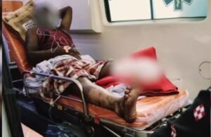 Read more about the article ବଳରାମ କୋଇଲା ଖଣିରେ ଶ୍ରମିକଙ୍କ ଉପରେ ଚଢ଼ିଗଲା ଚେନ୍‌ଡୋଜର୍ ଗାଡ଼ି, ଦୁଇ ଖଣ୍ଡ ହୋଇଗଲା ଗୋଡ଼